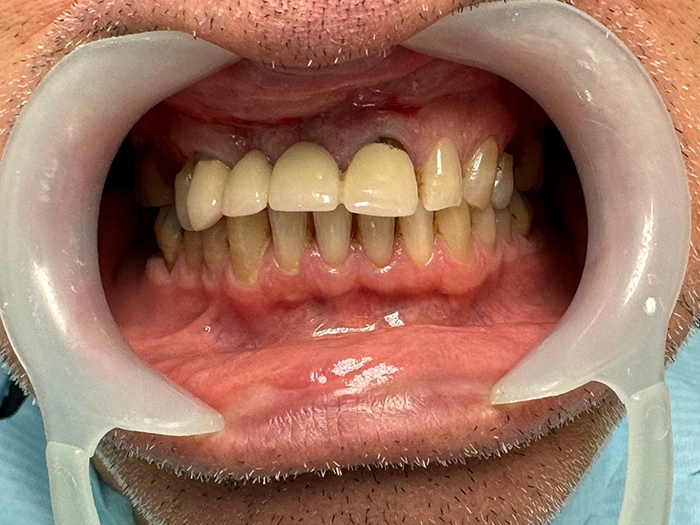 C1