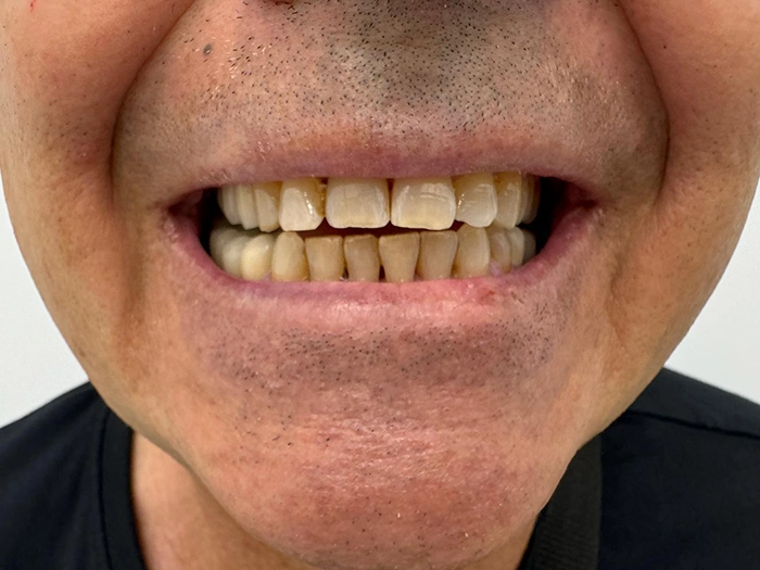 D1