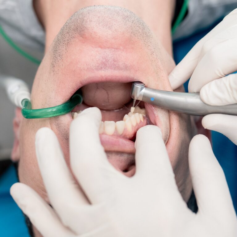 Instagram post from igeadental. This post is in position 2.